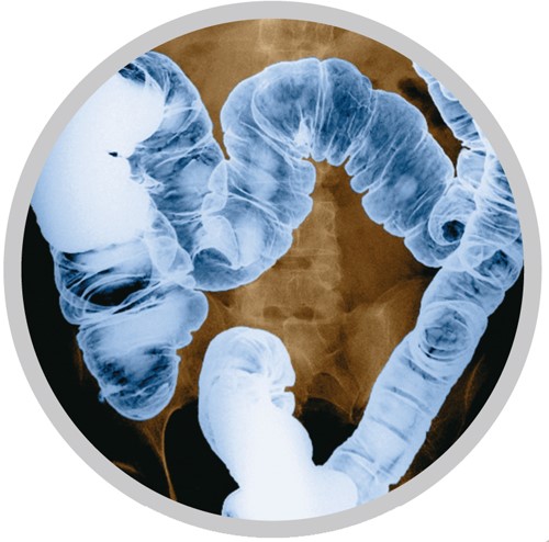 大肠的钡餐造影x线片