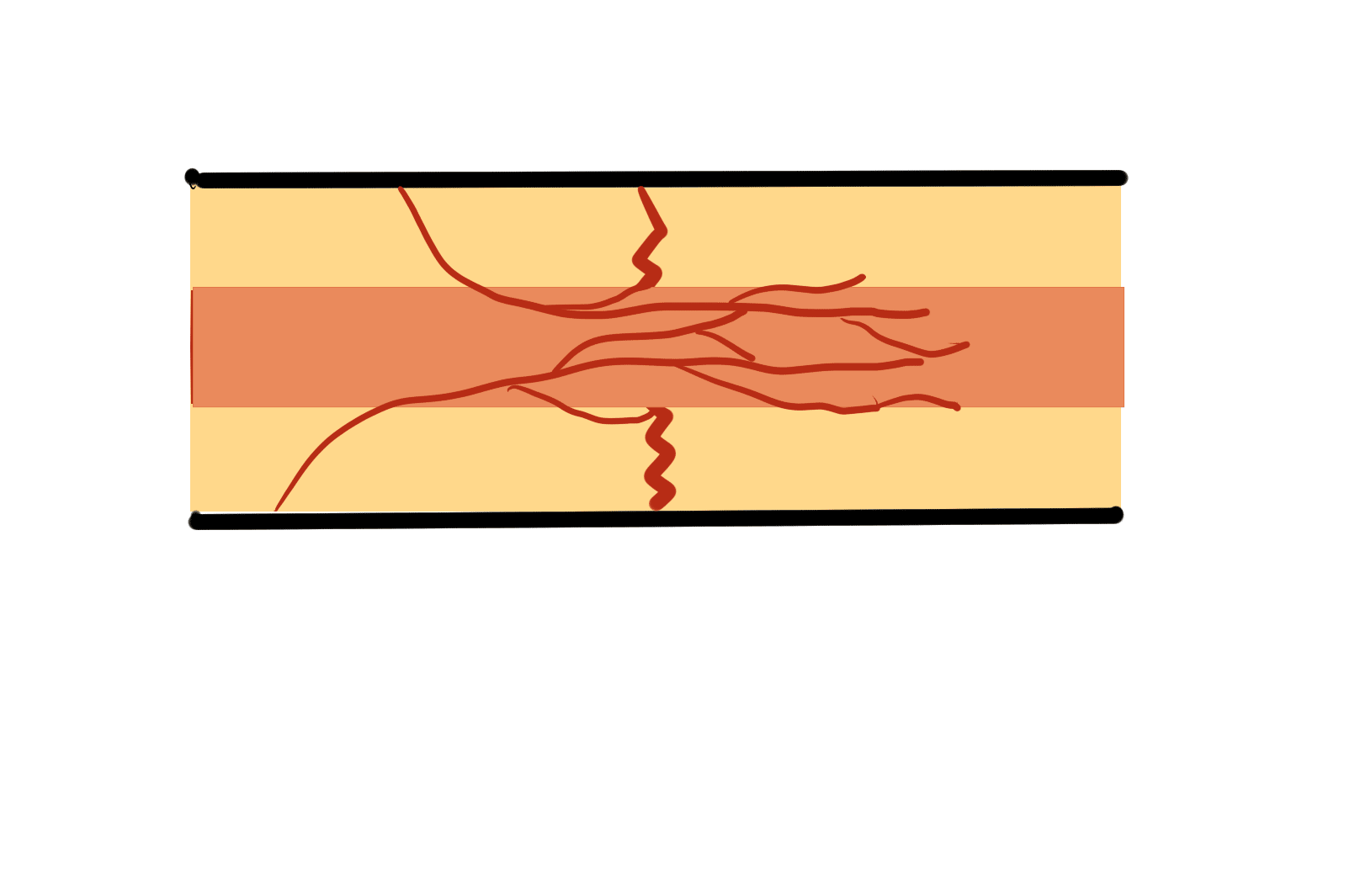 为什么伤筋动骨一百天呢
